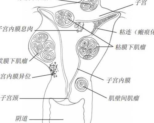 合肥正规供卵中心,合肥试管供卵中心