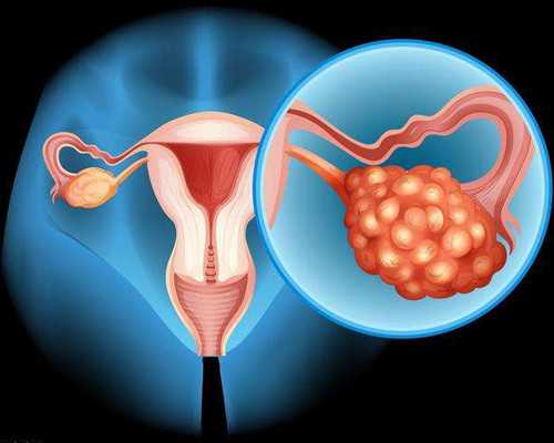 香港验血性别费用多少,怀孕42天香港查男女_验血查性别有什么需要注意的