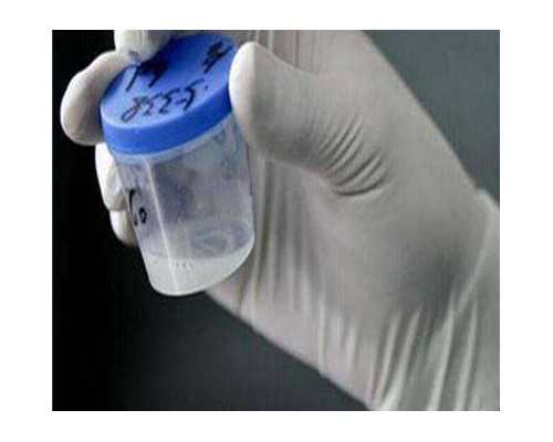 吃避孕药影响香港验血吗,试管婴儿都有什么方案？试管婴儿短方案好吗？