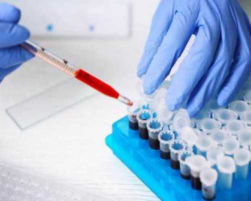 南昌上门收购古玩古董,怎么锻炼才能快速增重？3个增肌原则，让你告别瘦弱形