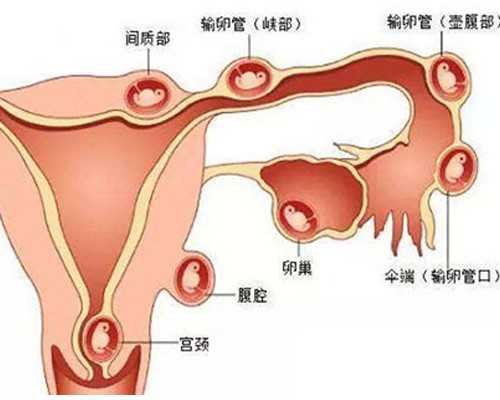 古玩鉴定培训学校 深圳学费多少钱_容易有家暴男的八字特征