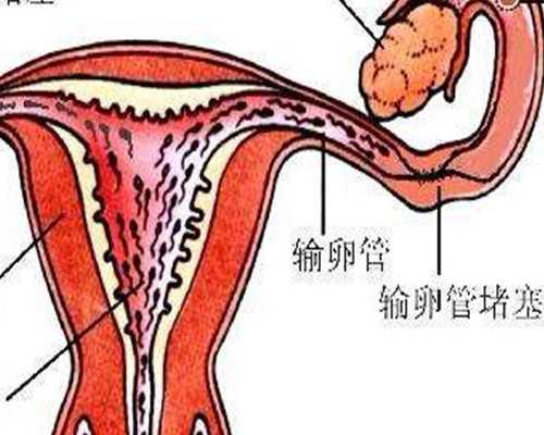香港验血要怀孕几天,这几种情况的多囊患者，应该尽快做试管婴儿