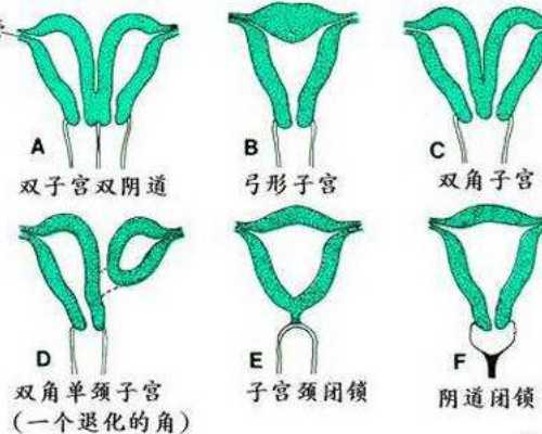 香港验血超过八周,试管双胎龙凤胎多还是同性多？试管都是龙凤胎吗？