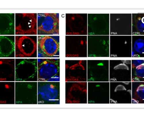 胎芽0.7香港验血准吗,子宫肌瘤月经期吃什么食物