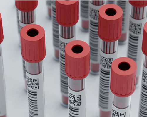 自己去香港验血还是邮寄好,自然流产后再备孕注意事项