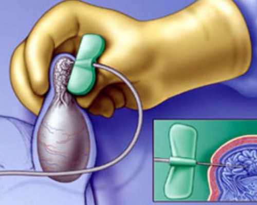 李成儒古玩虫2全集优酷,狮子和双鱼那叫一个虐狮子座讨厌双鱼座什么