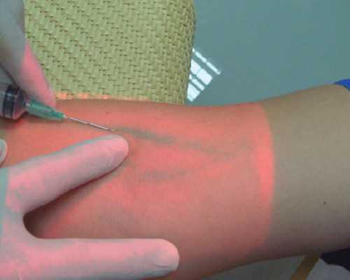 香港精准验血周六上班吗_通过中介香港验血测男女准不准,亲身经历告诉你最全