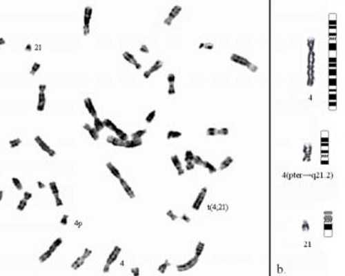 香港验血多数是女宝,泰国试管婴儿技术是否适用于支原体衣原体感染?