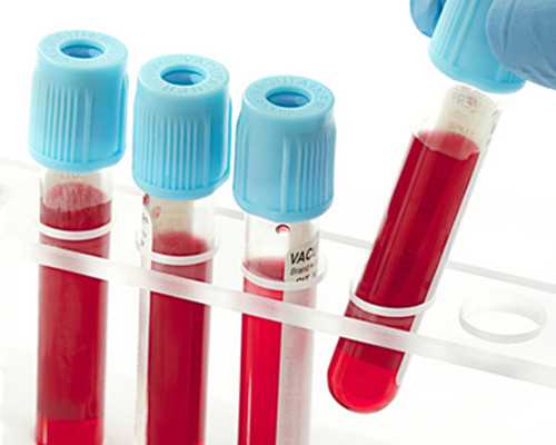 香港验血鉴定有没有不准的_内地去香港验血有科学吗？分享一下本人亲身经历