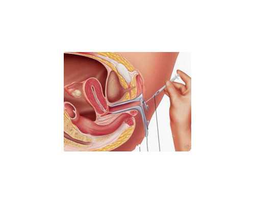 香港den验血官网,香港16周可以查性别吗_验血查性别是不是骗人的!