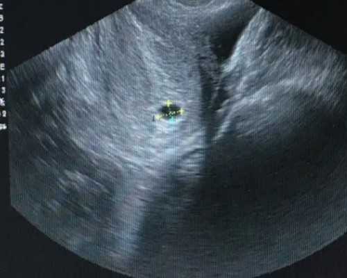 去香港验血化验男女需要多少钱,香港50天查性别邮寄血样_验血需要满足哪些条