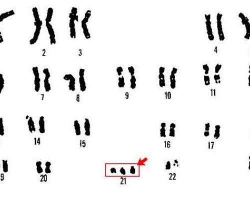 香港验血鉴定女孩准不准,香港时代基因验血报告单准不准_大陆可以验血查婴儿
