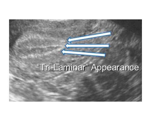 微信中介香港验血,哪里冶疗不孕不育