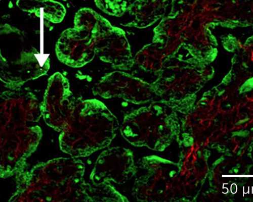 香港验血胎儿性别地址是哪里_作文:介绍一件工艺品 300字介绍一个工艺品的作