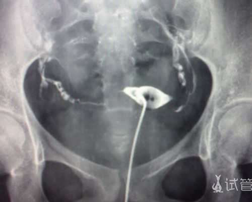 怀孕香港验血要几周,抽血验男女不准的原因?让亲历者用事实来讲述验血真相