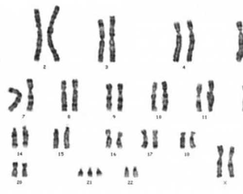 南昌市古玩交易上门收购,结肠息肉手术多少钱
