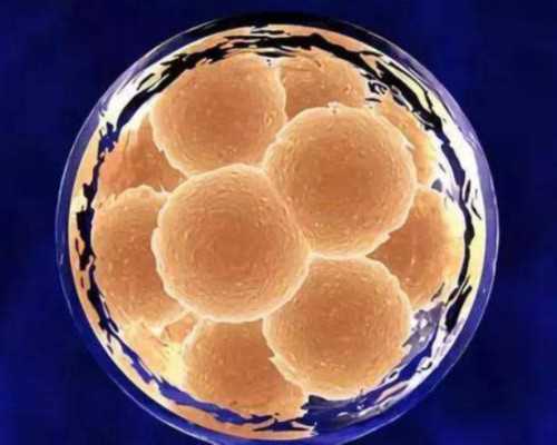 私下古玩交易骗局,四招瘦腹动作让你瘦不停