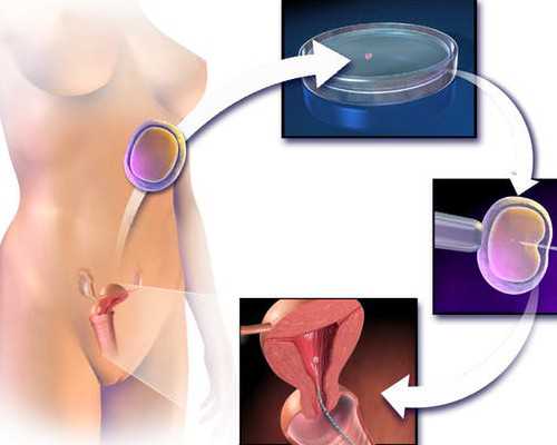 香港验血三大权威机构,试管婴儿每个人都需要做宫腔镜吗