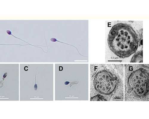 2014年香港验血多少钱,香港哪里有抽血胎儿鉴定在?亲身经历详细攻略