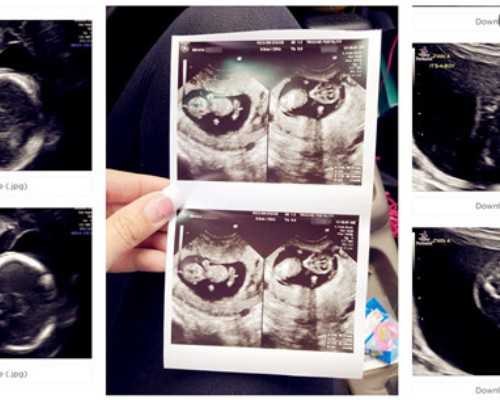 香港验血寄血是骗局吗_香港验血女孩生了男,测胎儿性别准确率高吗具备什么条