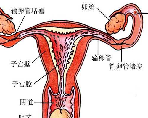 怀孕香港验血打掉, 艾滋病患者（HIV)能通过洗精在泰国试管婴儿拥有自己健康的