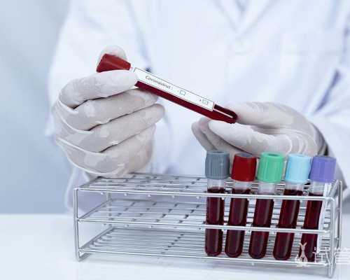 香港验血不找中介,香港刘蒂华诊所验血是真的吗_亲身经历详细攻略!