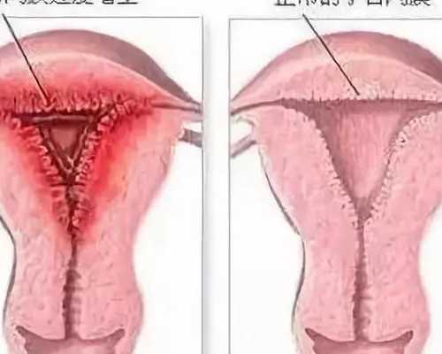 增城古董古玩鉴定机构,对爱情很谨慎，不会轻易交出真心的星座