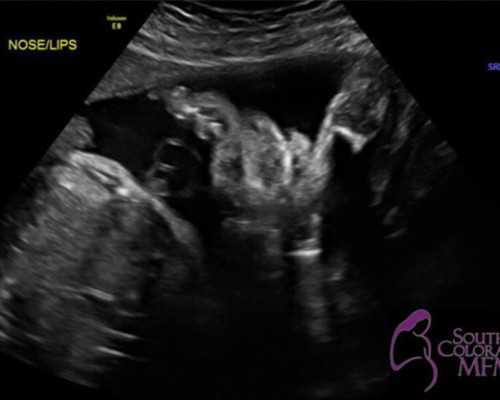 孕24周还能香港验血吗,香港抽血验dna_测性别选择哪家