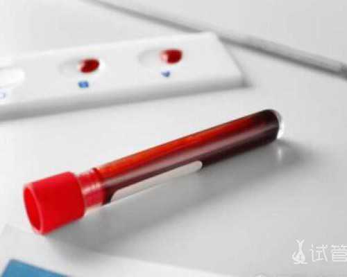 苏州古玩市场哪个最大_食美粥-美容抗衰粥系列|“紫米薏米粥”又称薏仁紫糯