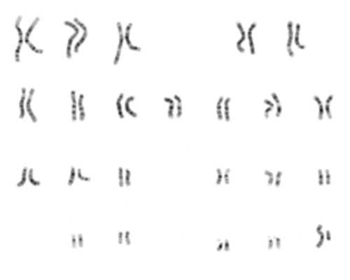 香港验血女孩该相信吗,孕三个月香港查男女准不准_查性别真的准确吗!