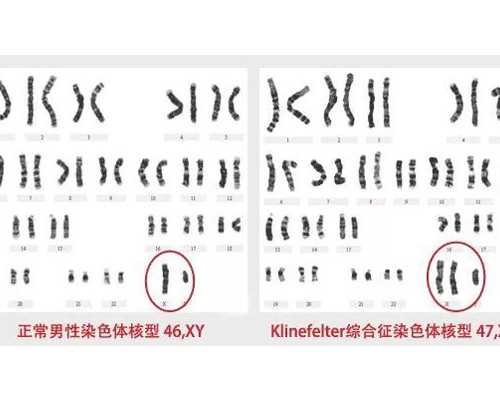 香港验血前的孕前检查吗_如何到香港验血准不准_抽血查性别是真还是假!