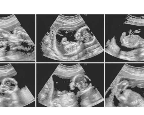 合肥代孕双胞胎价格,合肥试管公立医院有哪些最新排行榜名单公布