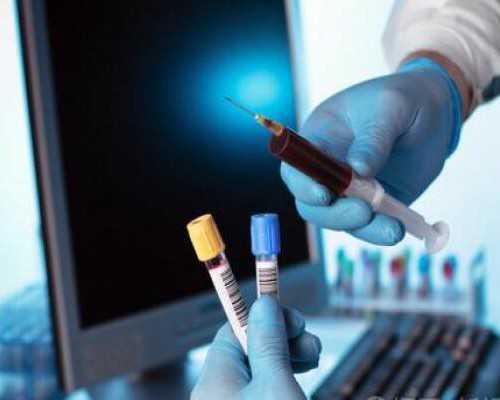 正规古玩拍卖公司流程,开胃鸡蛋汤