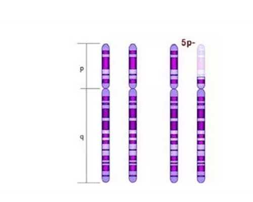 香港验血测性别多少钱,患有子宫肌瘤可以做试管婴儿吗？