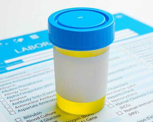 香港验血一定要中介吗,吃碱性食物，看清宫表，生男生女真的有秘方？应知道