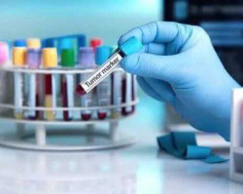 南昌去香港验血需要多少钱,香港验血报告单电子版,抽血鉴定性别要多少费用