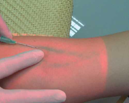 香港验血怀孕几个月,香港抽血测胎儿性别是真是假?要超过几个月?