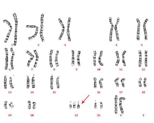 几次香港验血都是女孩,香港验血没有找到y_不骗人，只要2600!