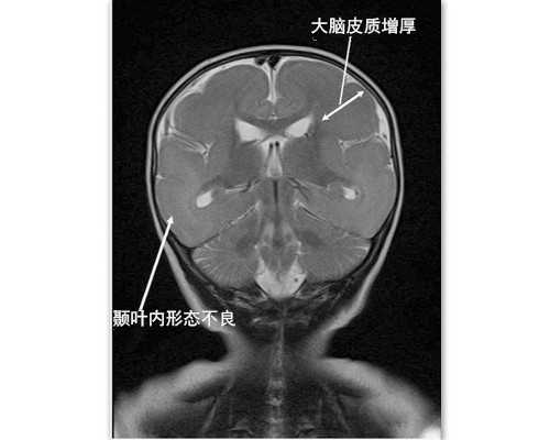 香港早孕验血有出错的吗,香港查男女多少天能查_抽血查性别是真还是假
