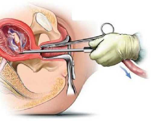 天涯社区 香港验血_怀孕到香港验血准确吗_七周验血测男女到底准不准